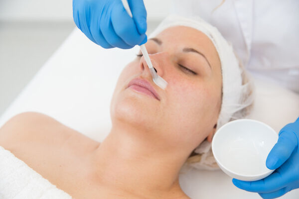 Chemical Peel